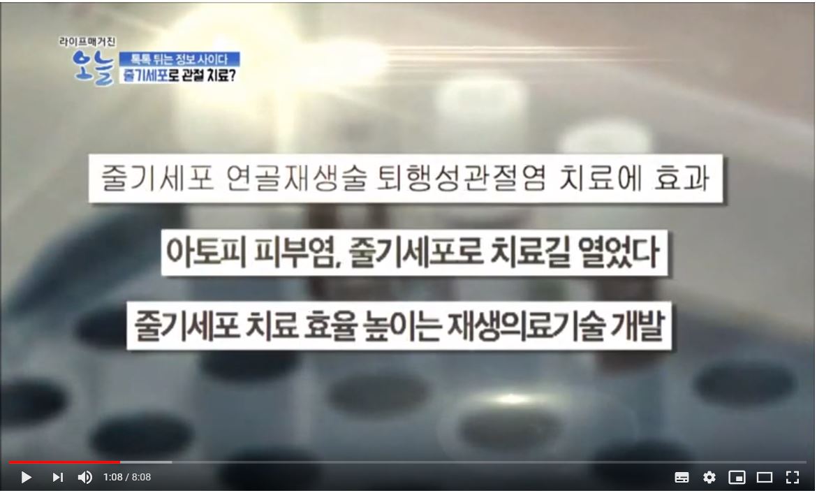 obs 라이프매거진 오늘에 소개된 미라셀줄기세포